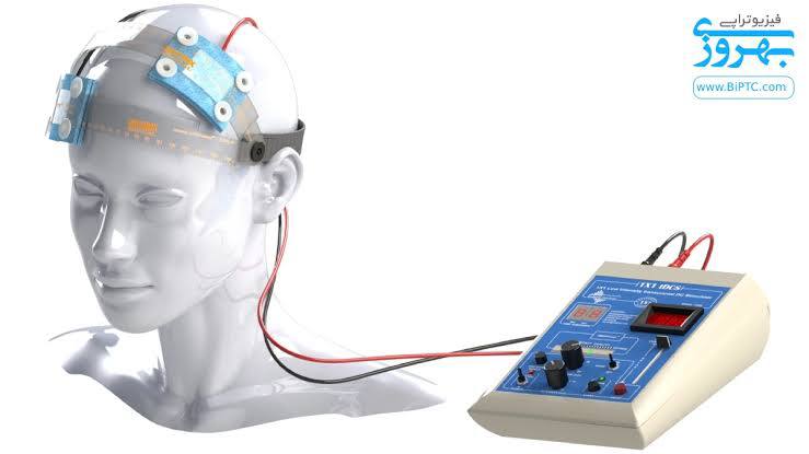 نحوه قرارگیری الکترودها