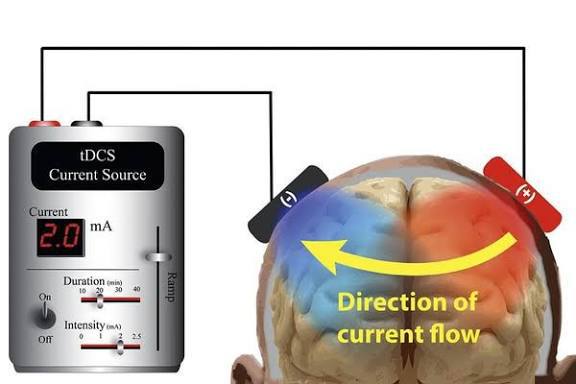 کاربردهای TDCS